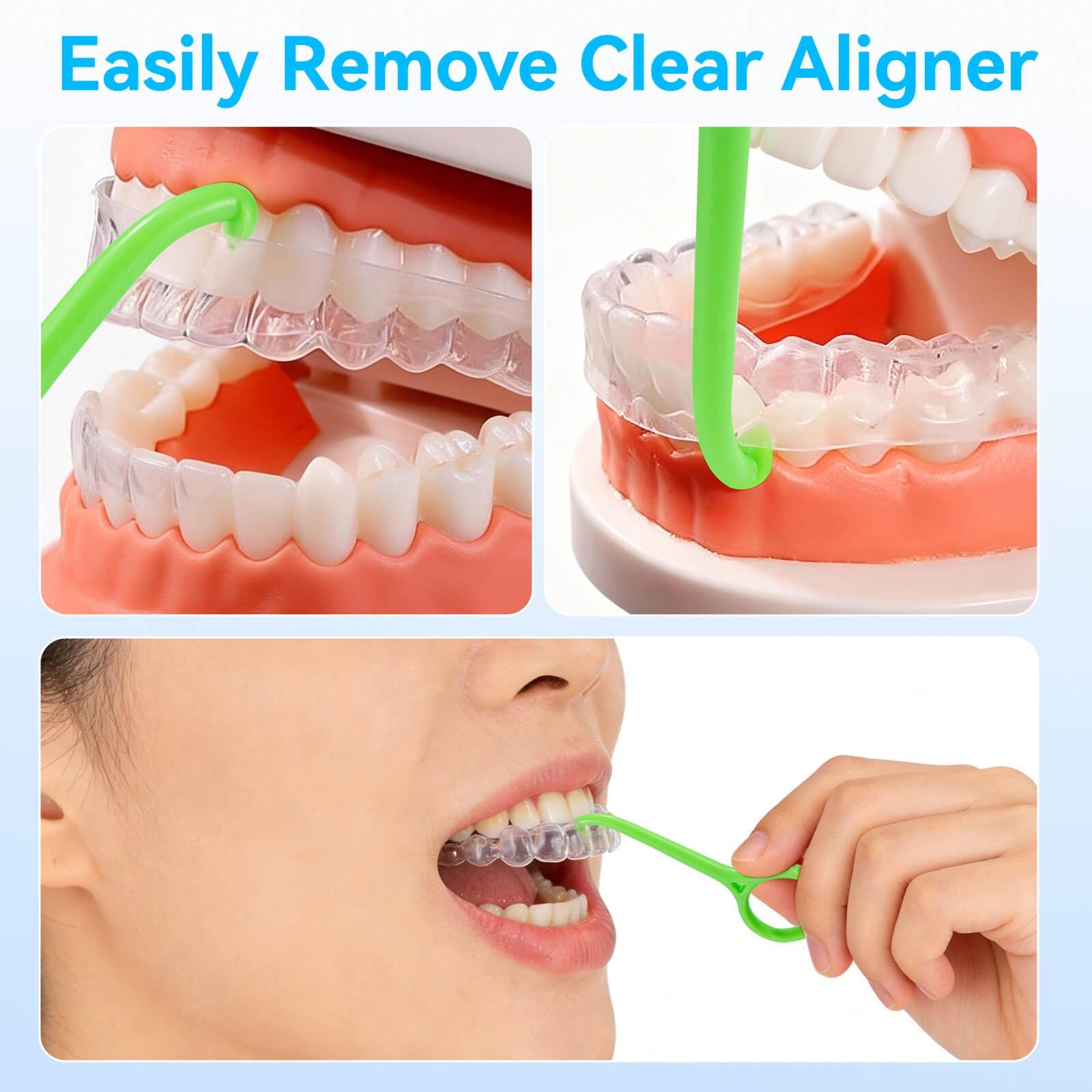 15PCS Clear Aligner Remover Tool for Red, white, blue, green, cyan