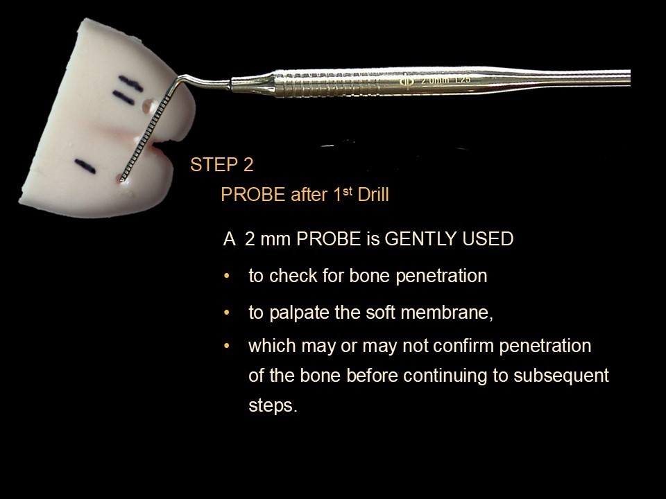 Lateral Window Sinus Elevation Drill Set, with elevator instrument set
