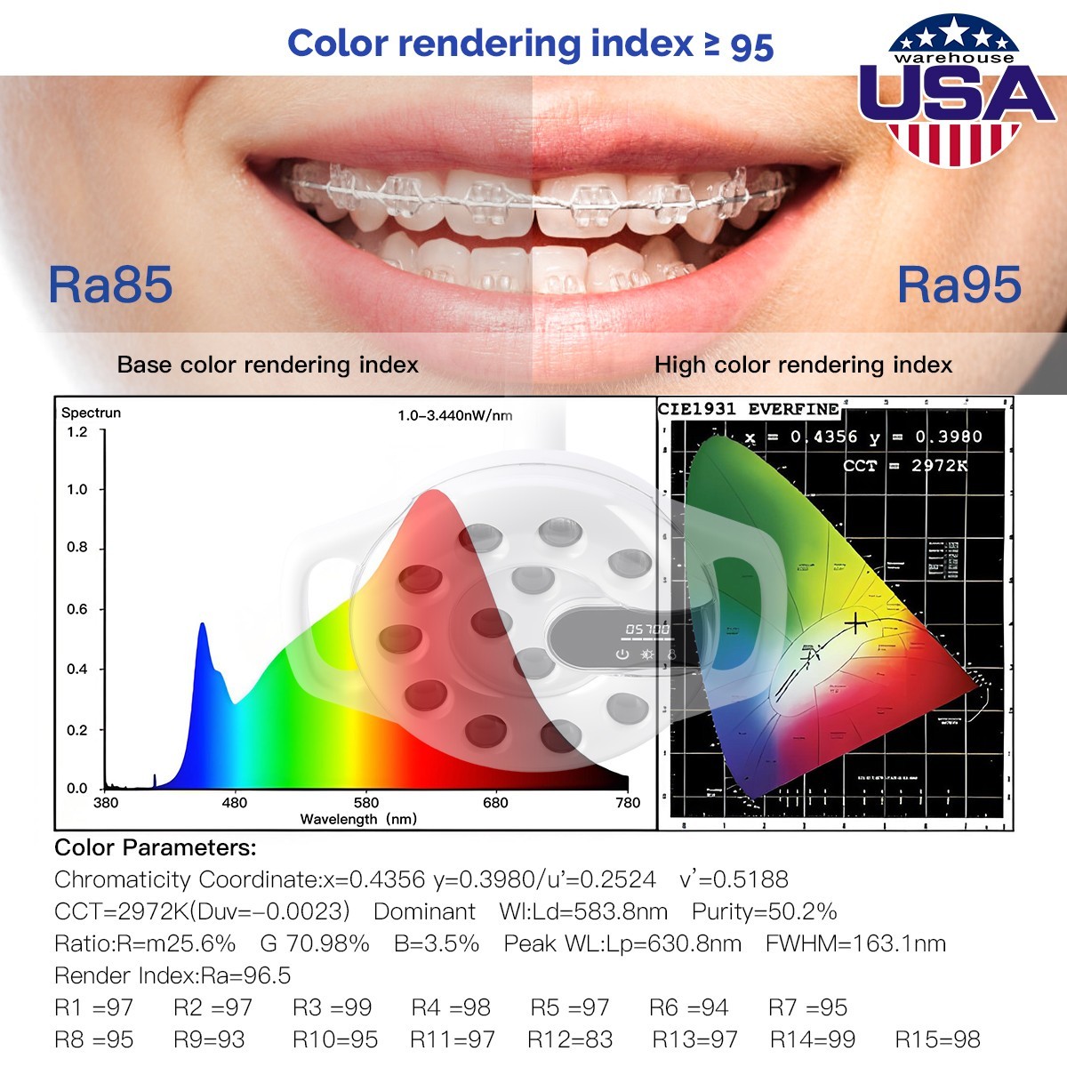 Lámpara Oral LED Dental con Doble Temperatura de Color 3000-5700K 90000 Lux