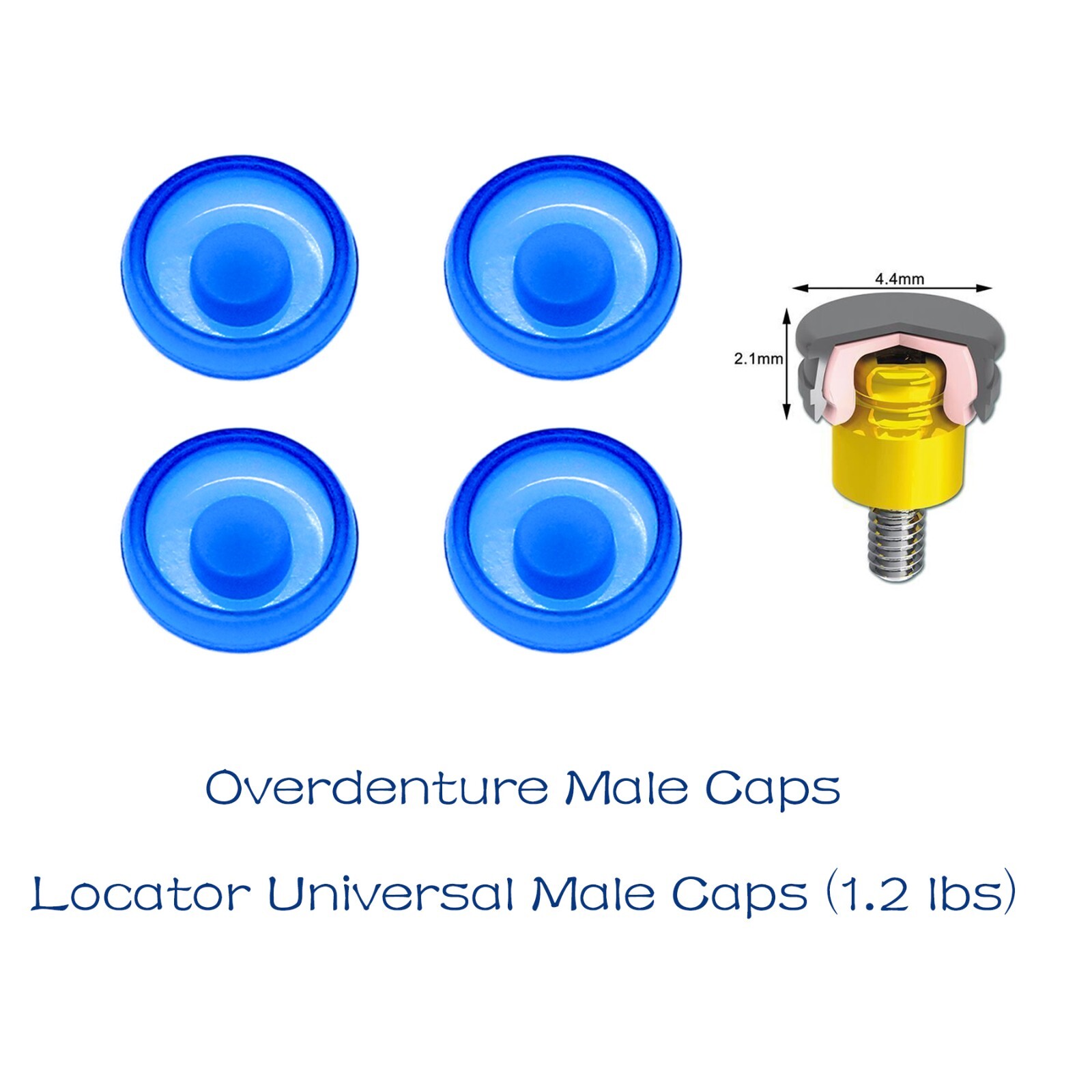 US Dental Locator Overdenture Abutment Retention Cap Male caps Inserts set