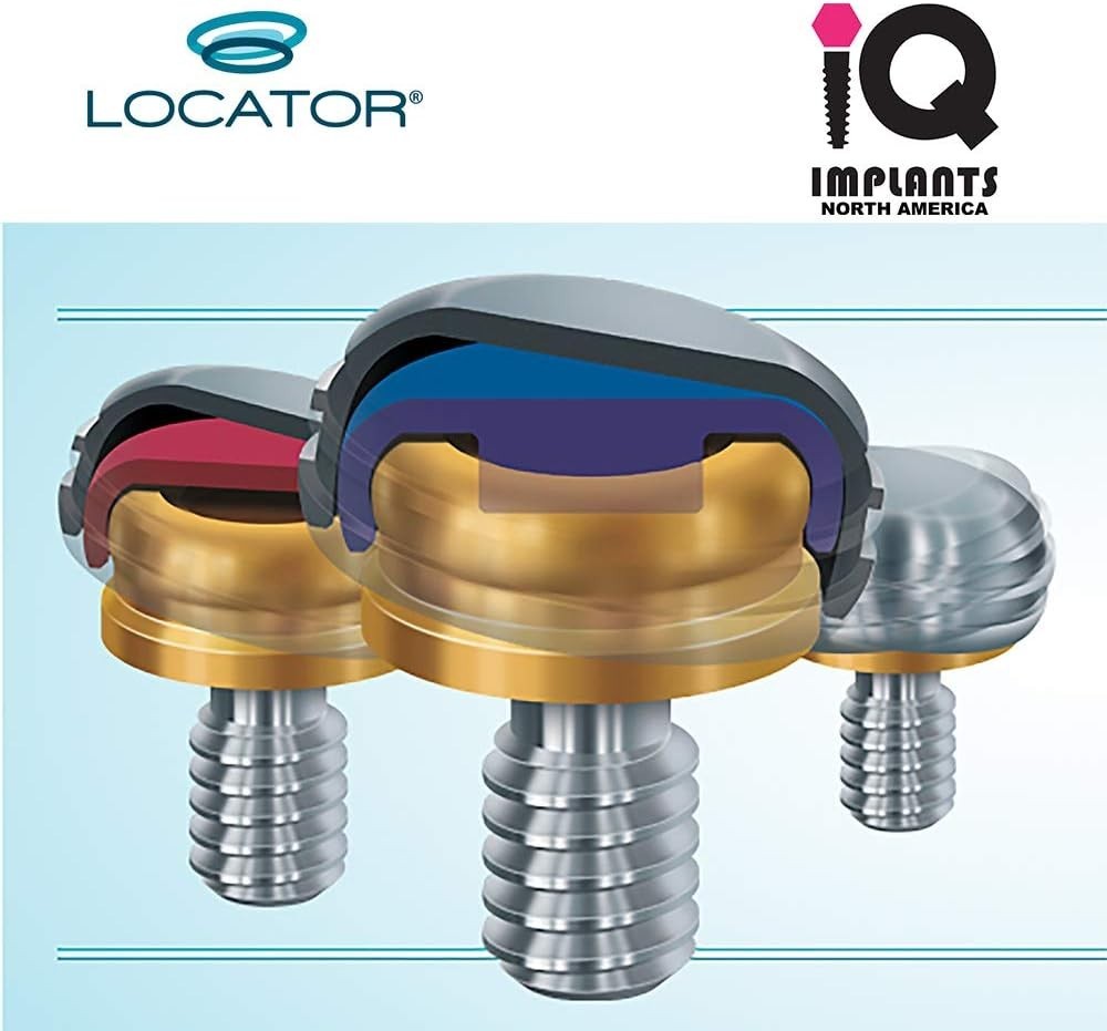 Locator Genuine Replacement Male Retention Inserts Caps, Standard, Light Ret…