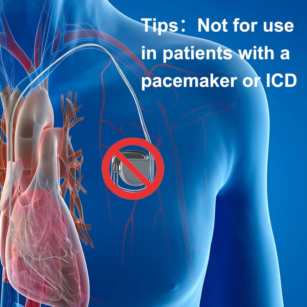 24 hours ECG/EKG Holter Monitor System with AI analysis Detects Afib PC Software