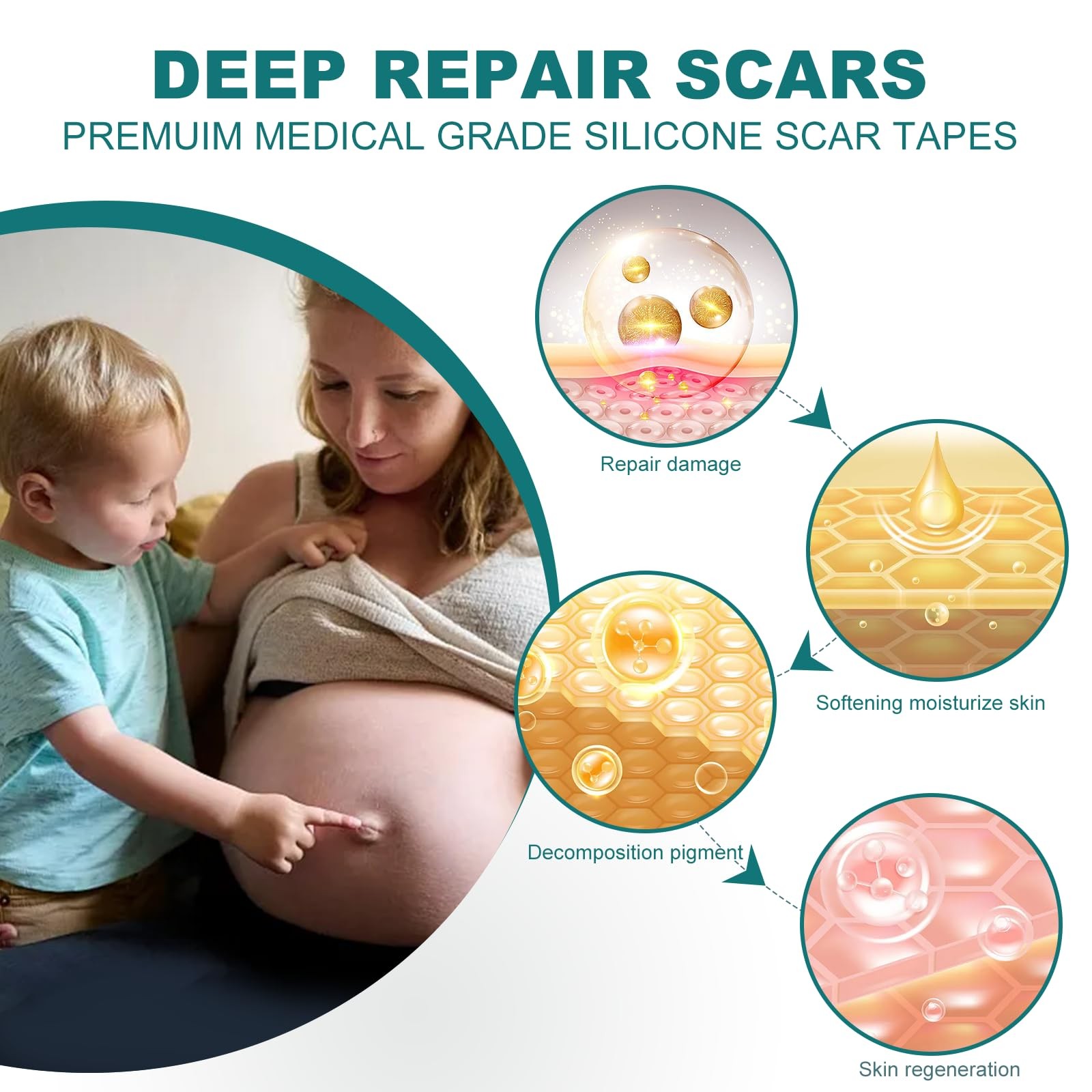 Silicone Scar Sheets (1.6″x 158″ Roll-4M), Medical Grade 1.6″×158″, no