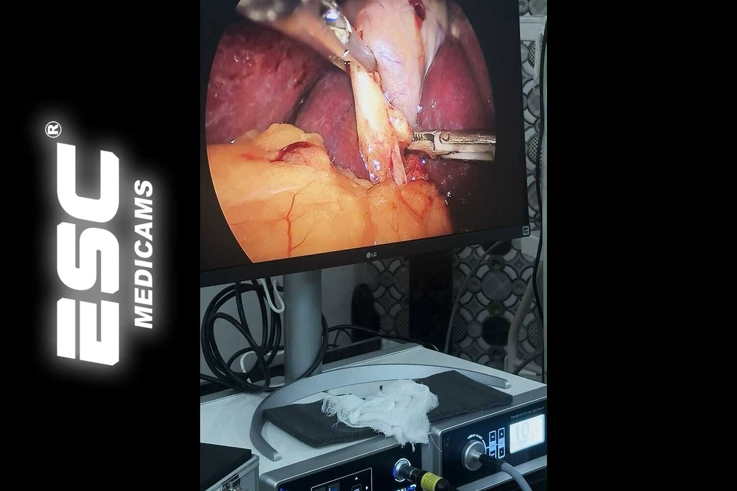 Full HD Endoscopy Laparoscopic Camera for Storz Stryker Medical Rigid Endoscope