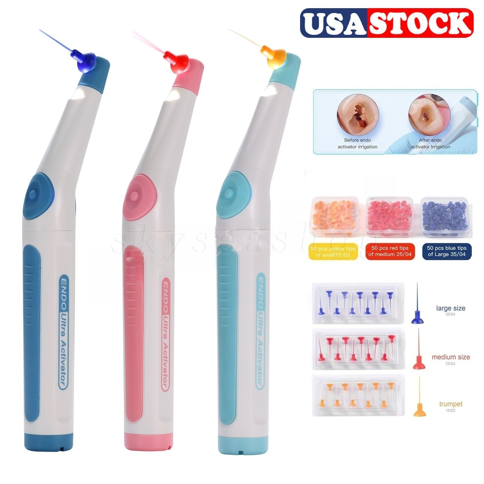 Dental Wireless Ultrasonic Activator Endo Ultra Activator with 150 Tips 3 Colors