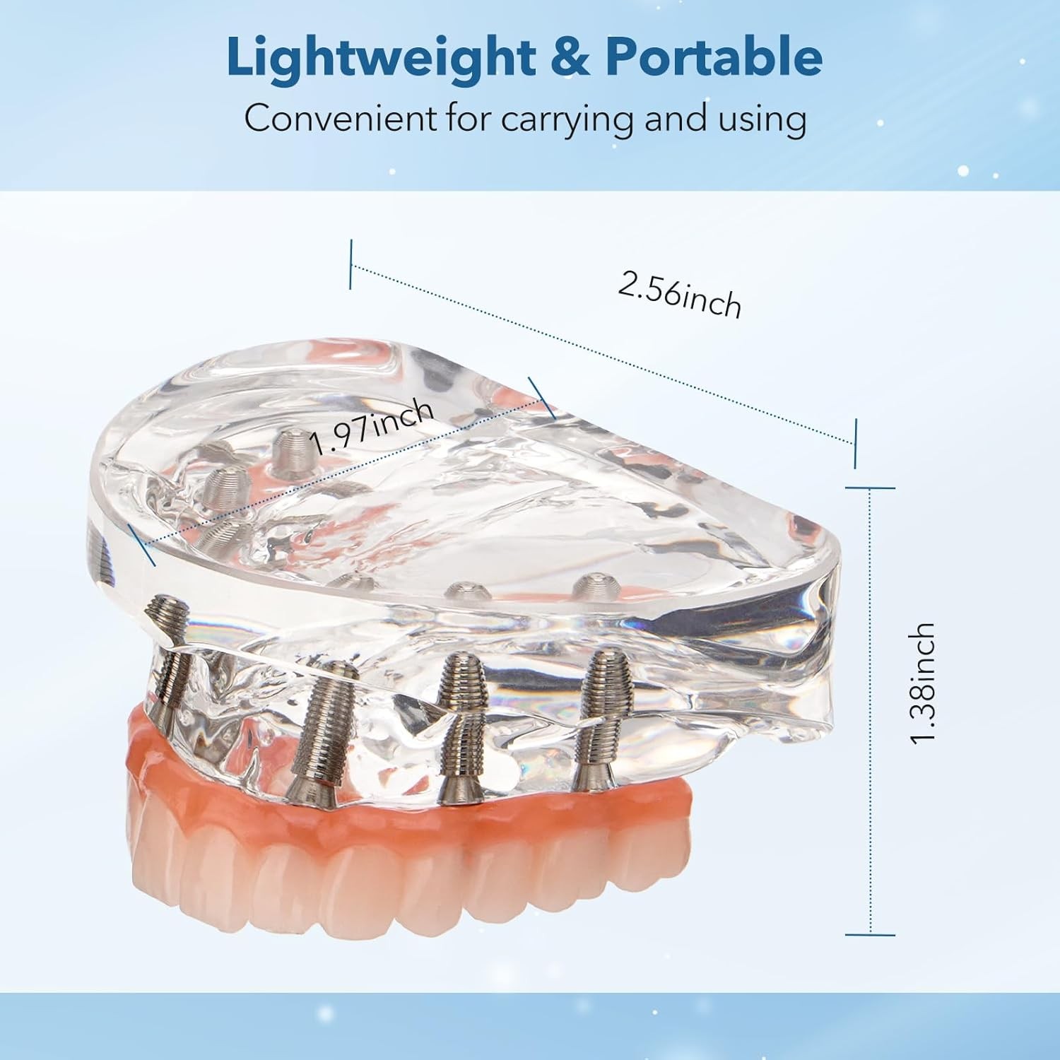 New Dental Implant Model All-on-4 All-on-6 Overdenture U/L Jaw 4/6 Screws Clear