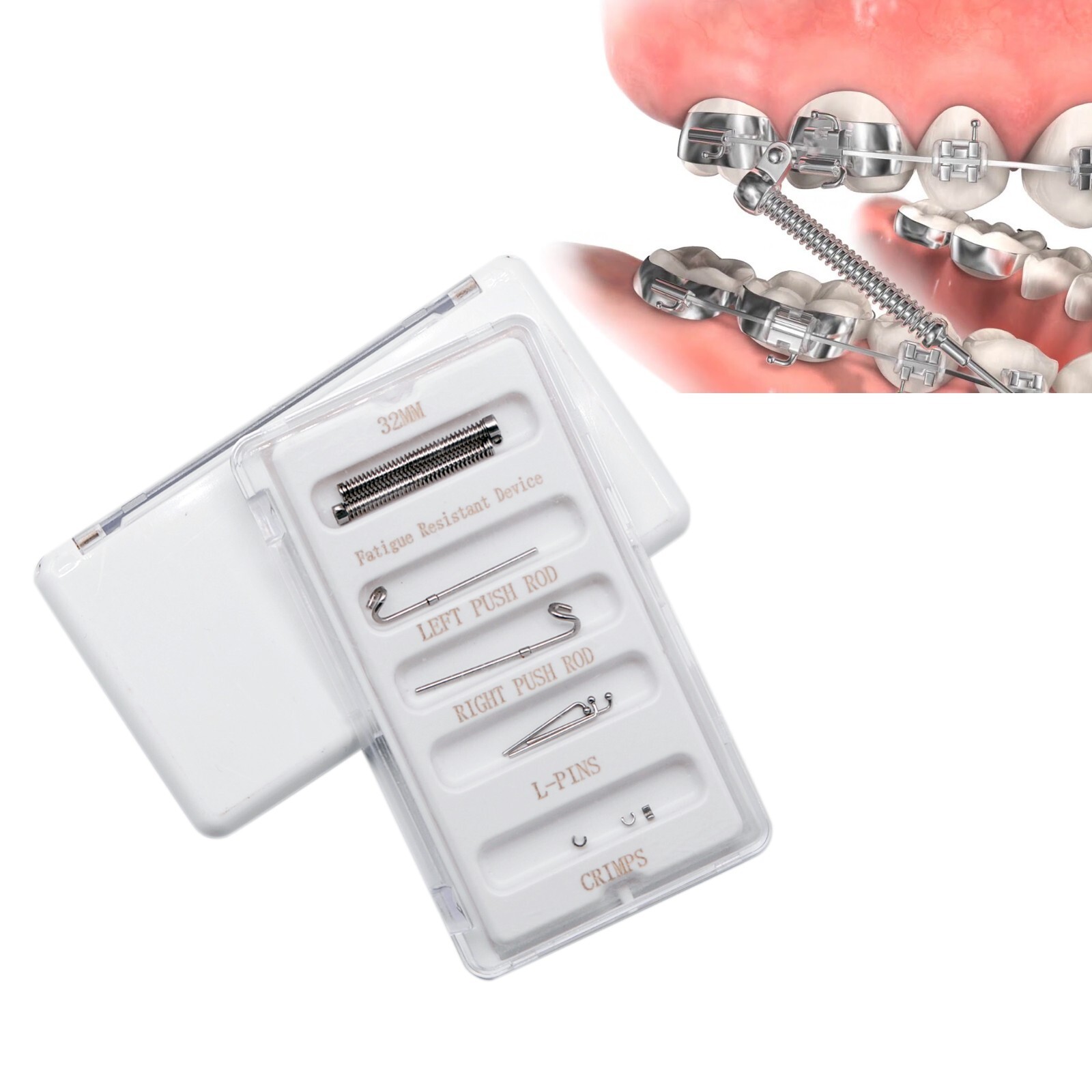 Orthodontic Dental Class II Malocclusion Appliances Fatigue Resistant Device