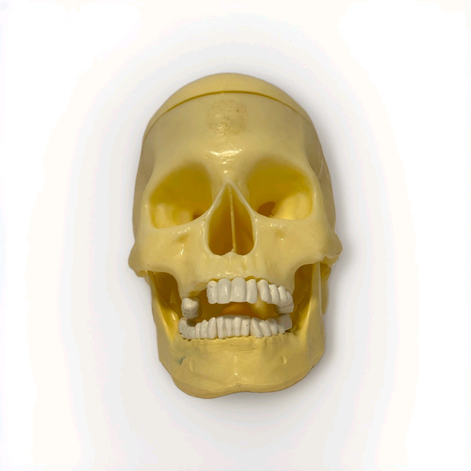 Vintage Anatomy Model Skull: Removable Skull Cap & Hinged Jaw Missing Some Teeth