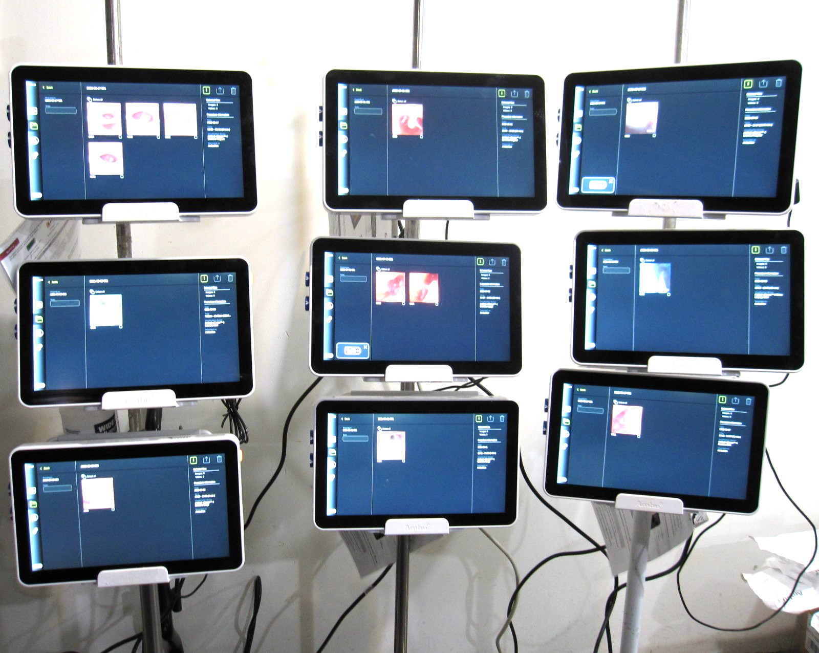 Ambu aView 2 Advance 405011000 Touchscreen Monitor, Power Supply, Mount TESTED
