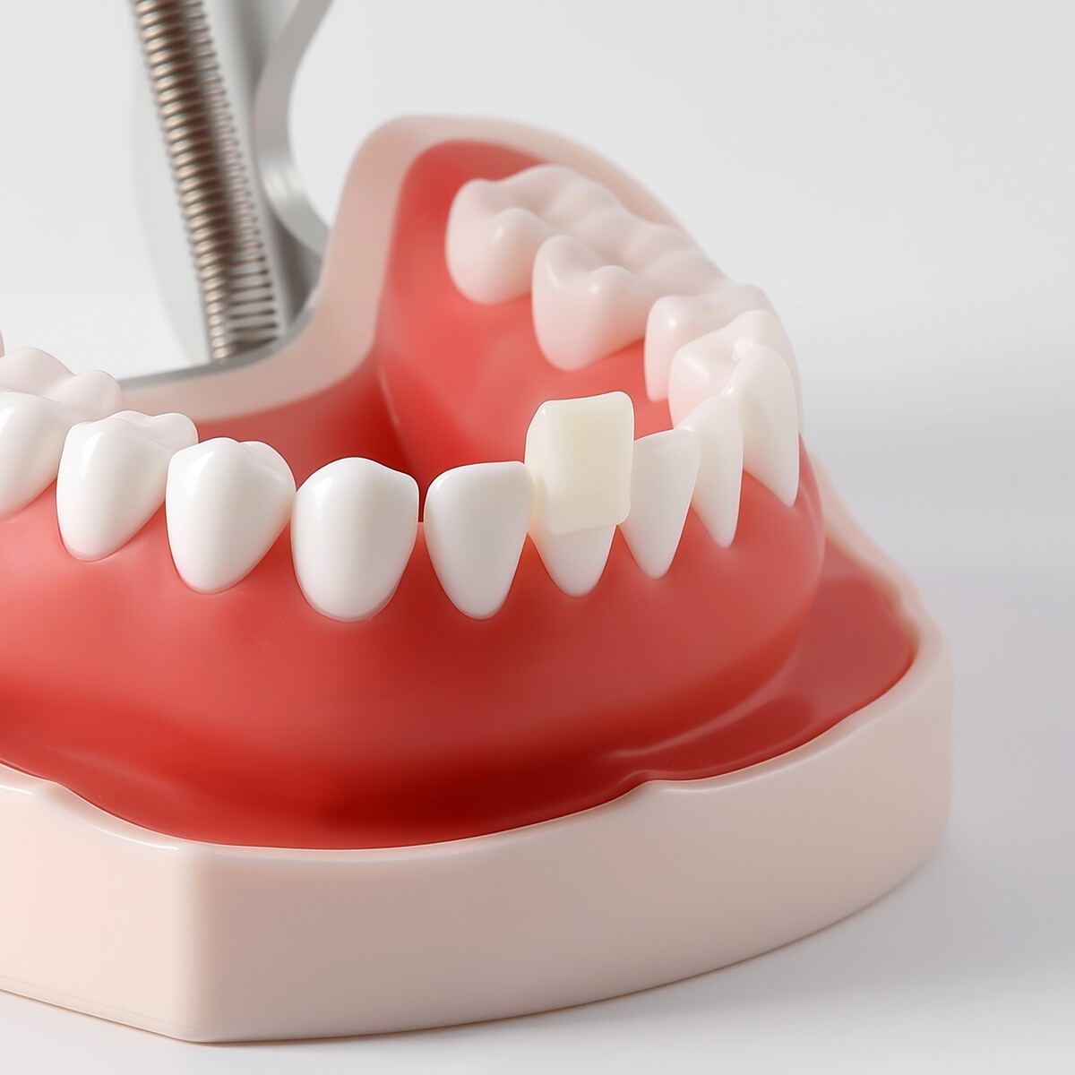 Dental Resin Anterior Dental Temporary Porcelain Crown Veneers Stable Teeth