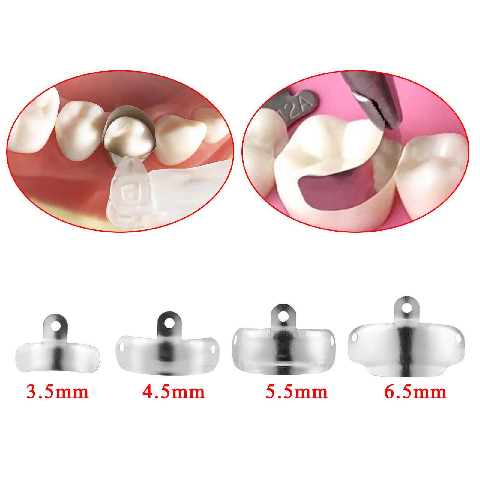 Palodent V3 Plus Style Dental Sectional Matrix Band Narrow Ring Clamp FDA