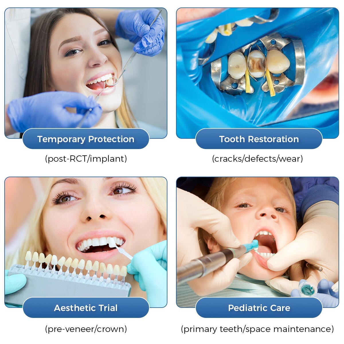 Dental Resin Anterior Dental Temporary Porcelain Crown Veneers Stable Teeth