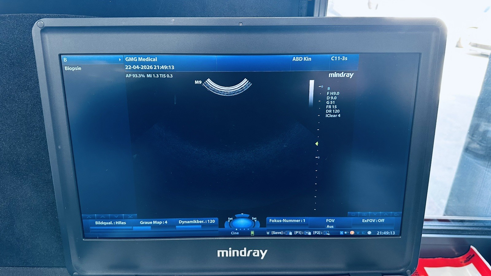 Mindray C11-3s Curved Array Transducer 101639