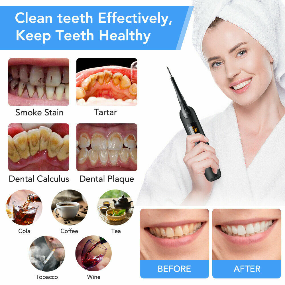 Ultrasonic Electric Tooth Cleaner Dental Scaler Stain Remover Teeth Cleaning Kit