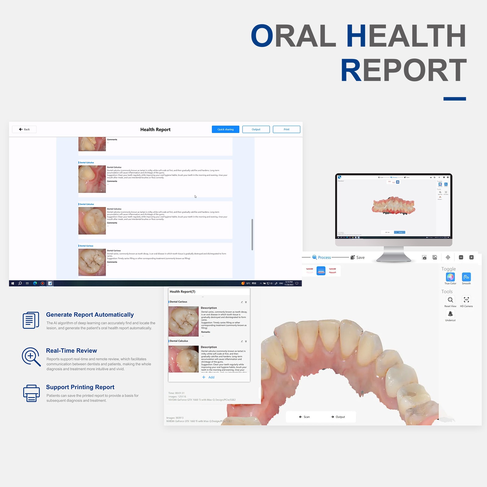 Digital Dental Impression High Precious 3D Intra Oral Scanner Factory Price