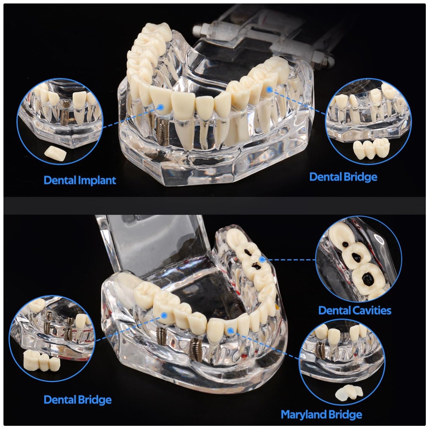 Dental Teaching Tool with Removable Teeth
