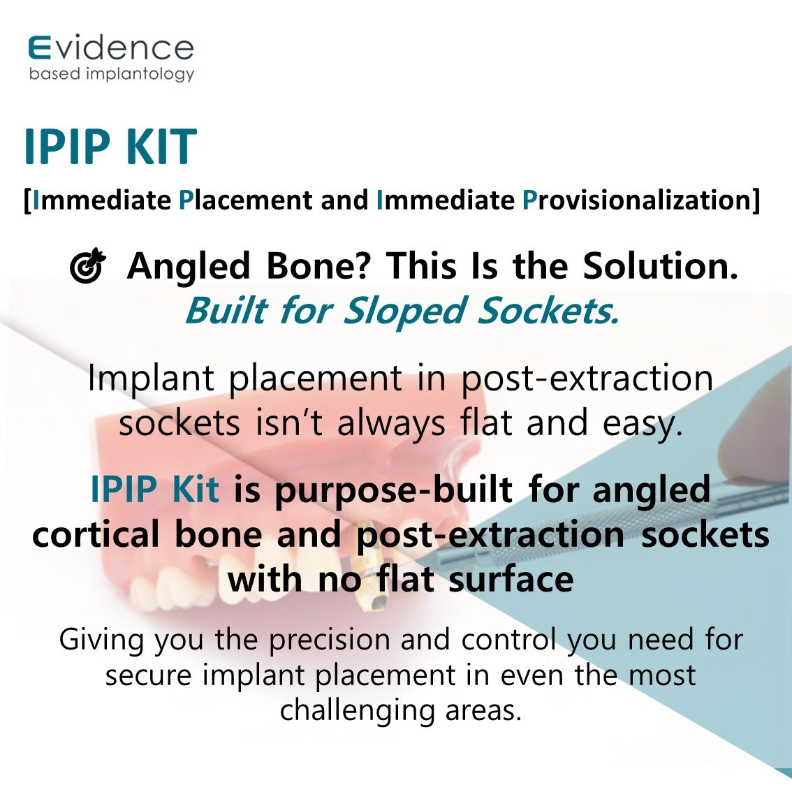 Evidence Implant IPIP Kit