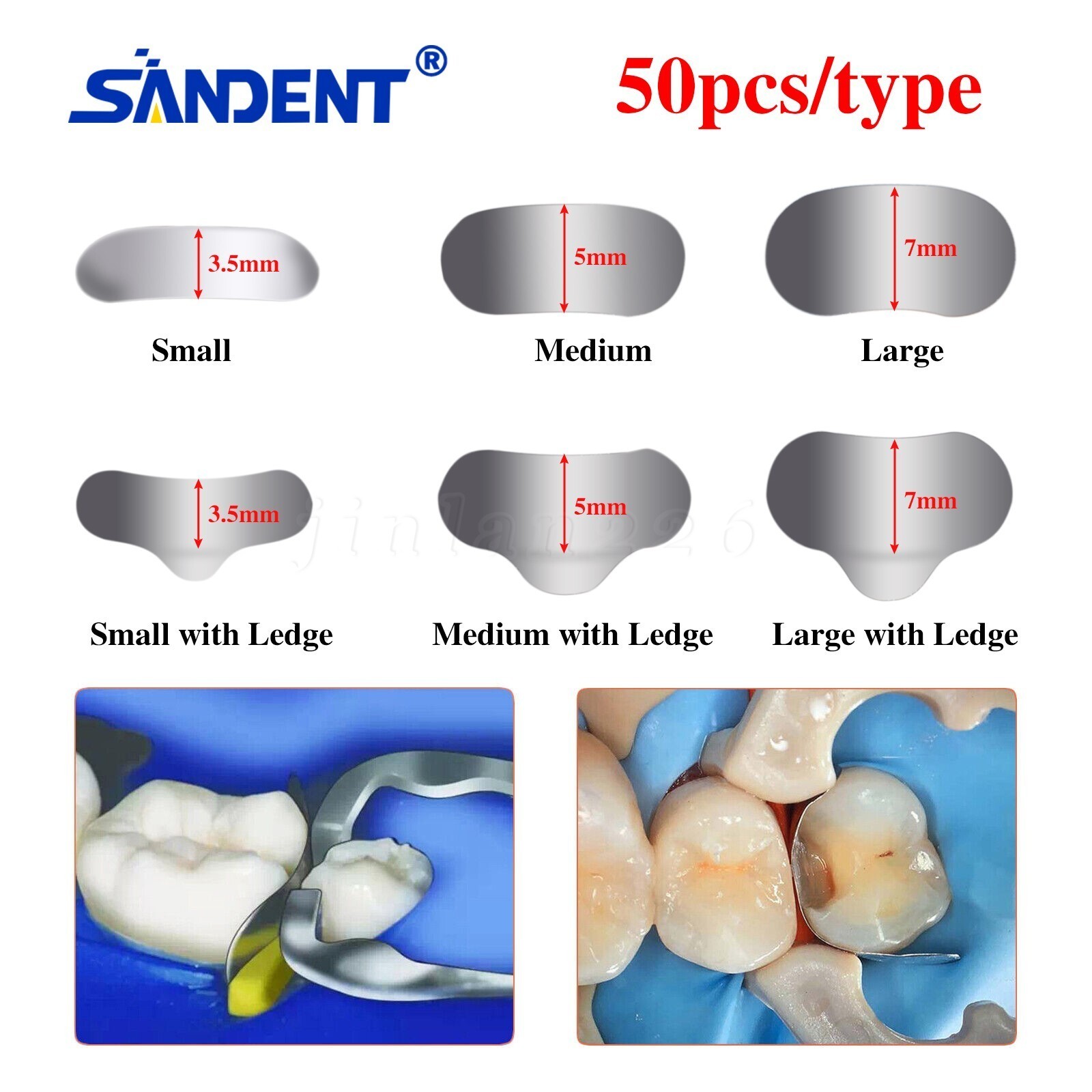 100 Pcs Dental Sectional Contoured Metal Matrices Refill Matrix Band Ledge 35um