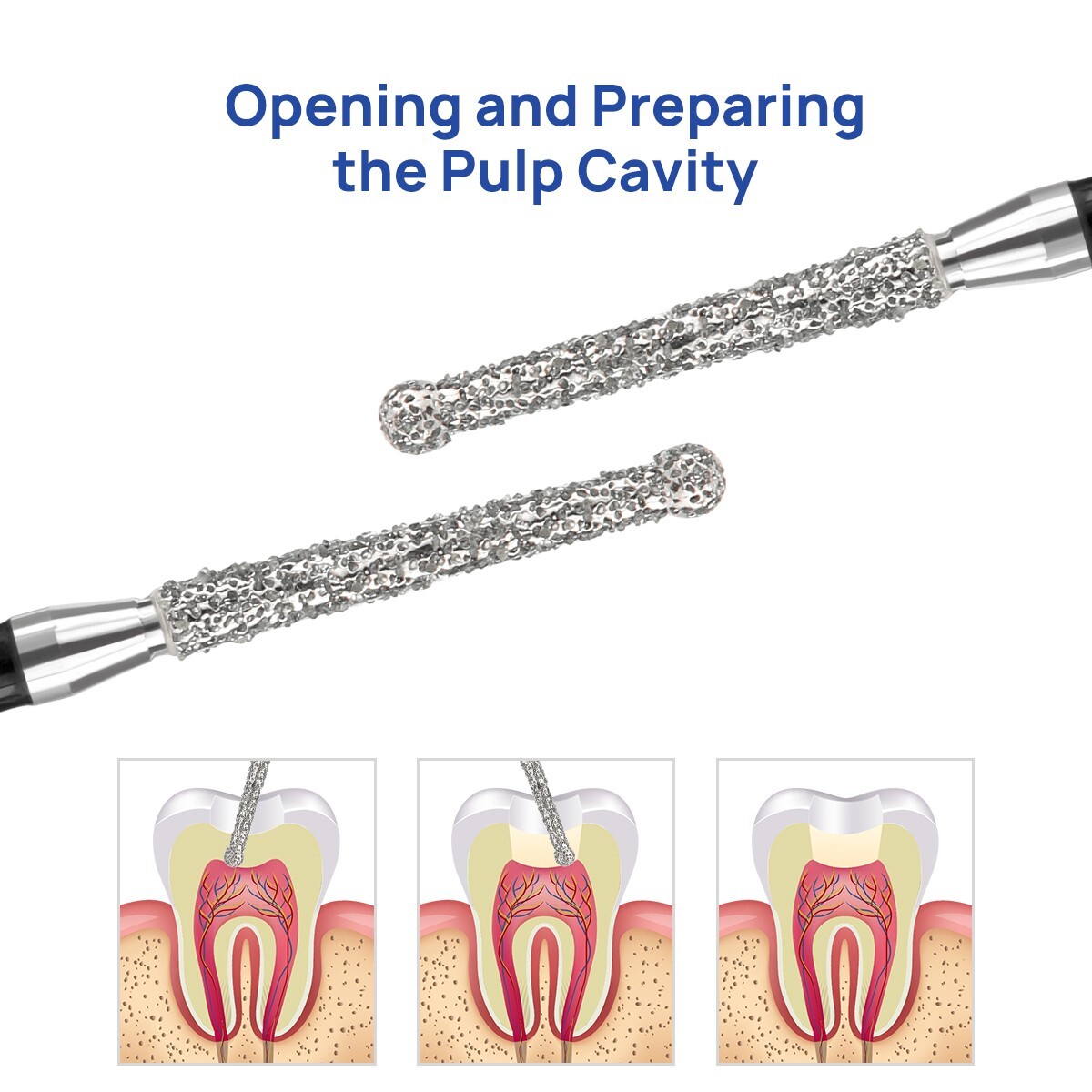 Dental Diamond Burs Composite Polishing /Endo Access Bur Open Preparing Pulp Bur