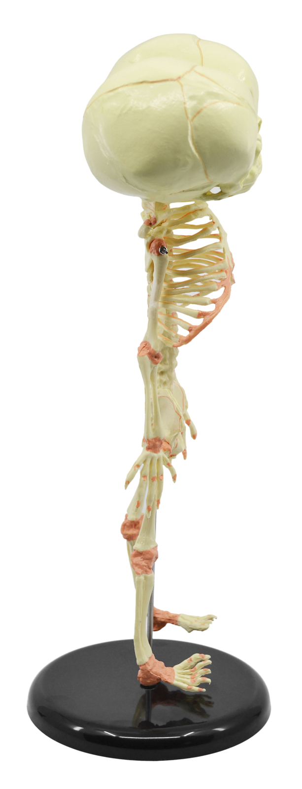 Infant Fetus Skeleton Model, Mini Size – Twin, Conjoined Skull – Eisco Labs