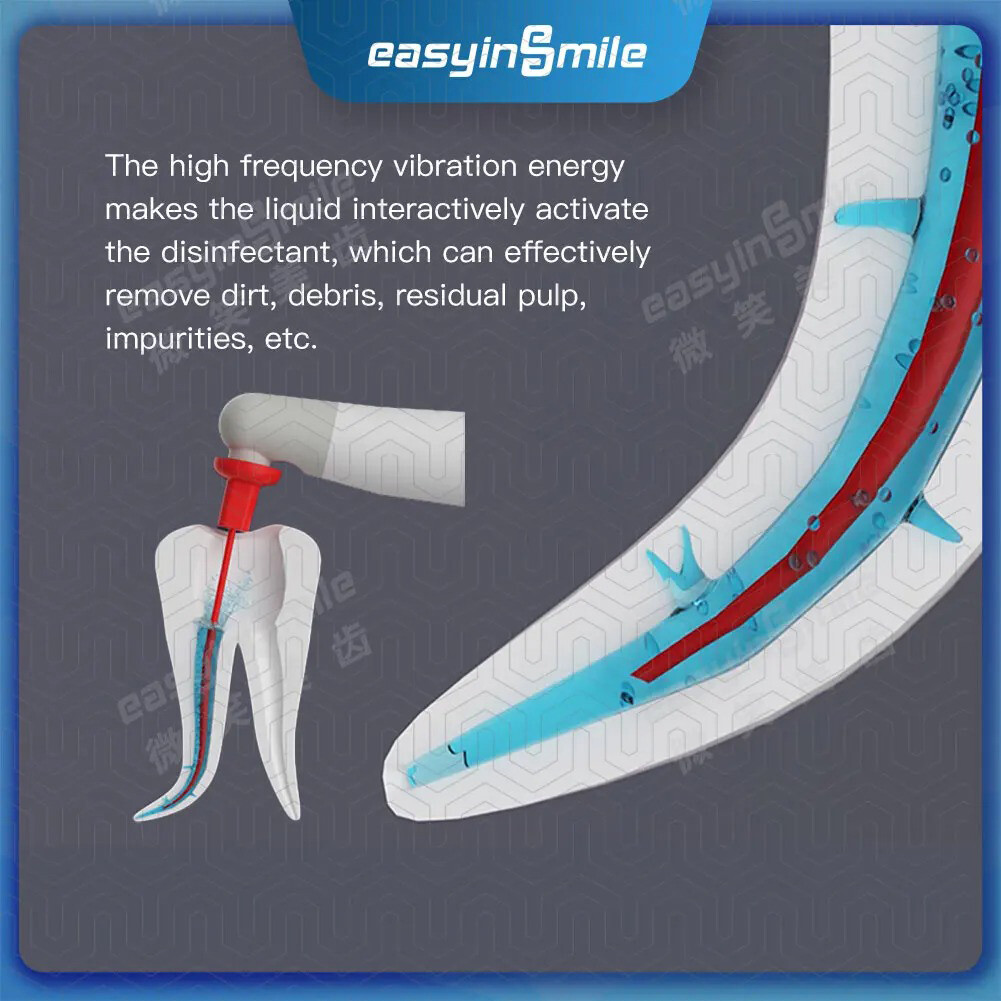 Endo Sonic Activator Dental Endodoncia Ultra Irrigator Root Canal Clean 60 Tips