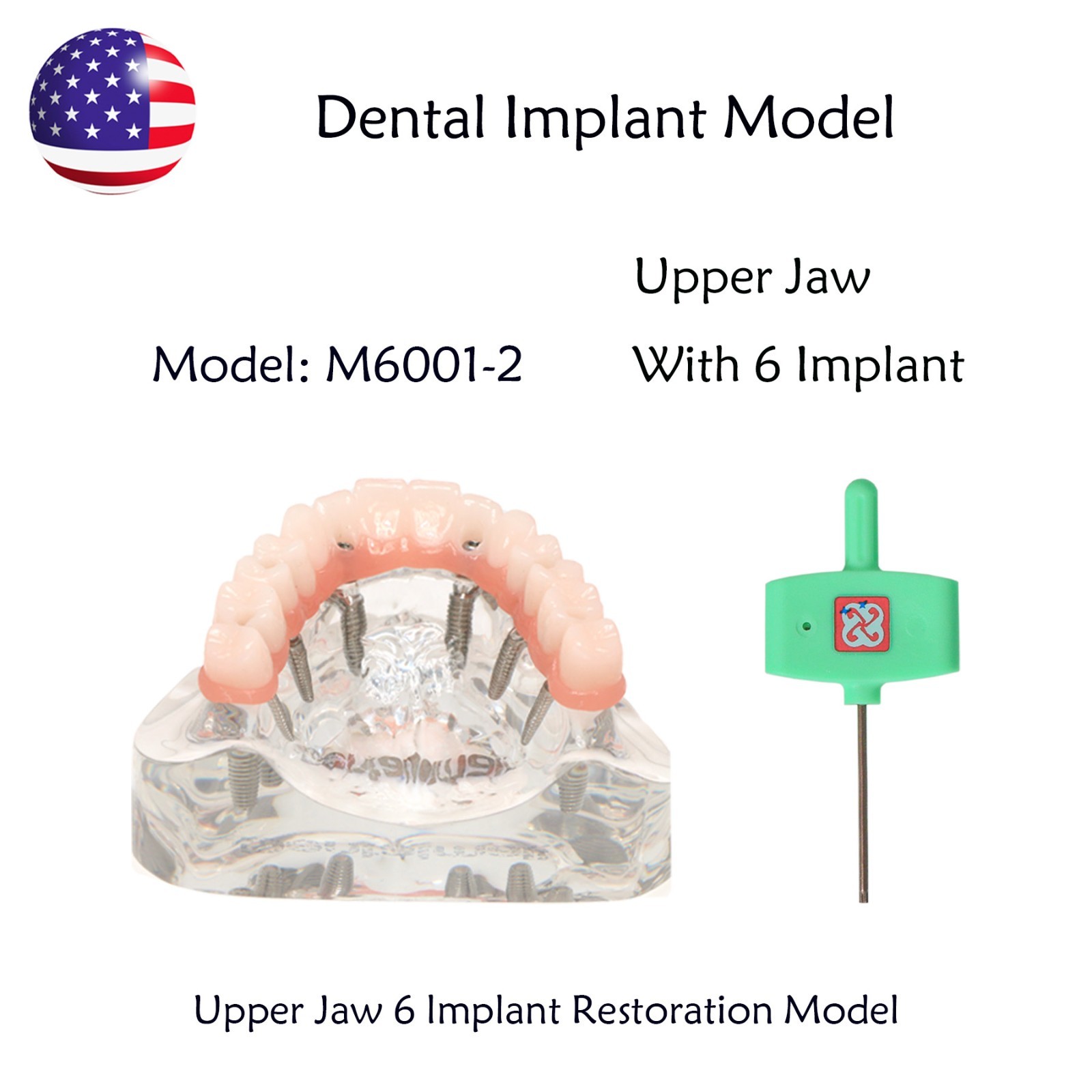 US Dental Implant Overdenture Model All-on-4/6 Upper Jaw Restoration 4/6 Screws