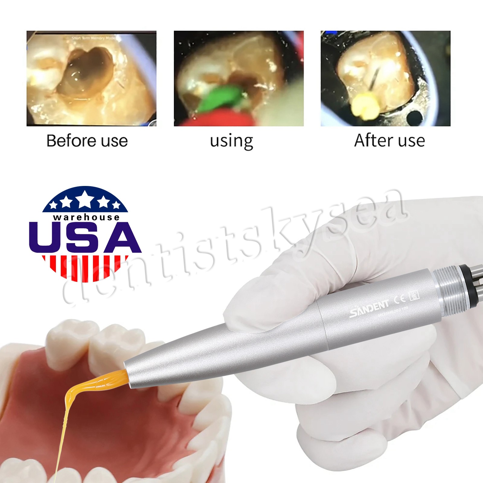Dental Endo Irrigation Tip Irrigator VDW EDDY KaV NSK Air Scaler Handpiece Tips