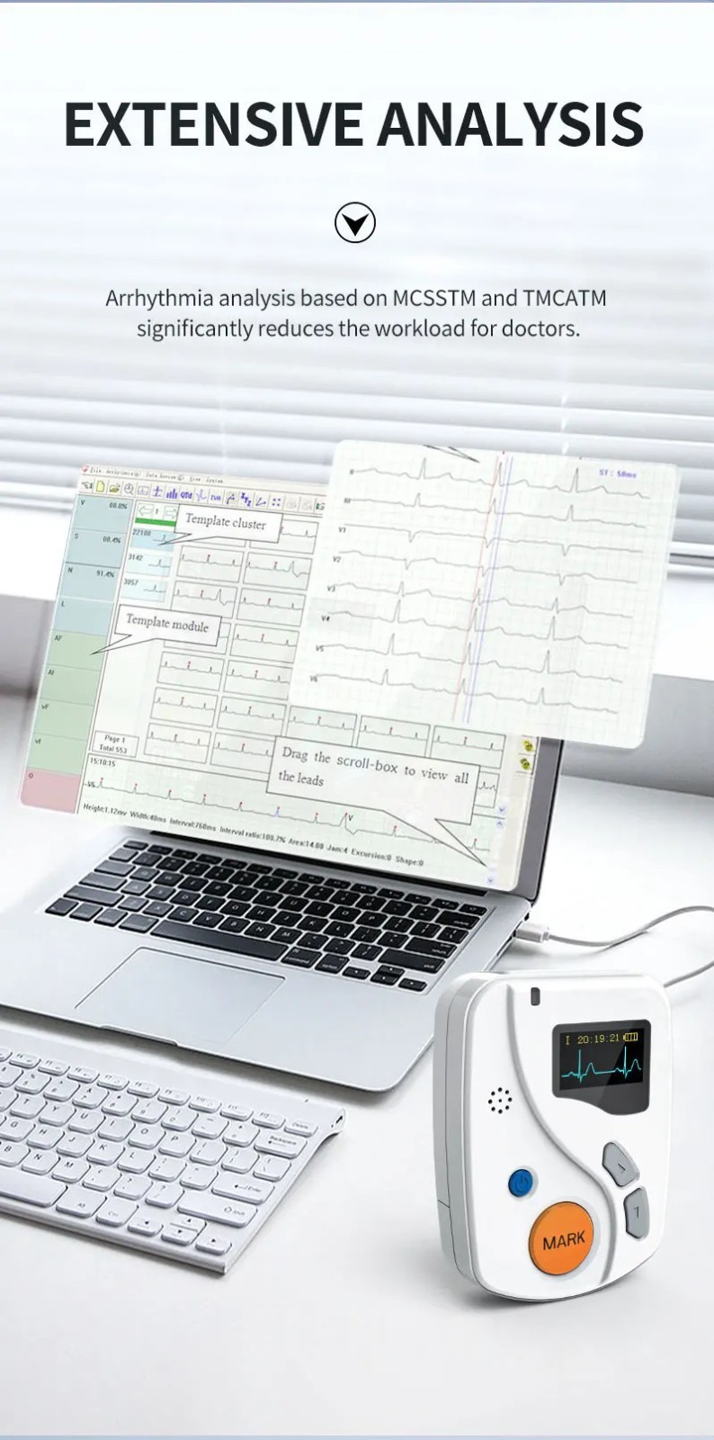 24 Hours Dynamic ECG Systems 12 Channel EKG Monitor ECG holter Recorder Software