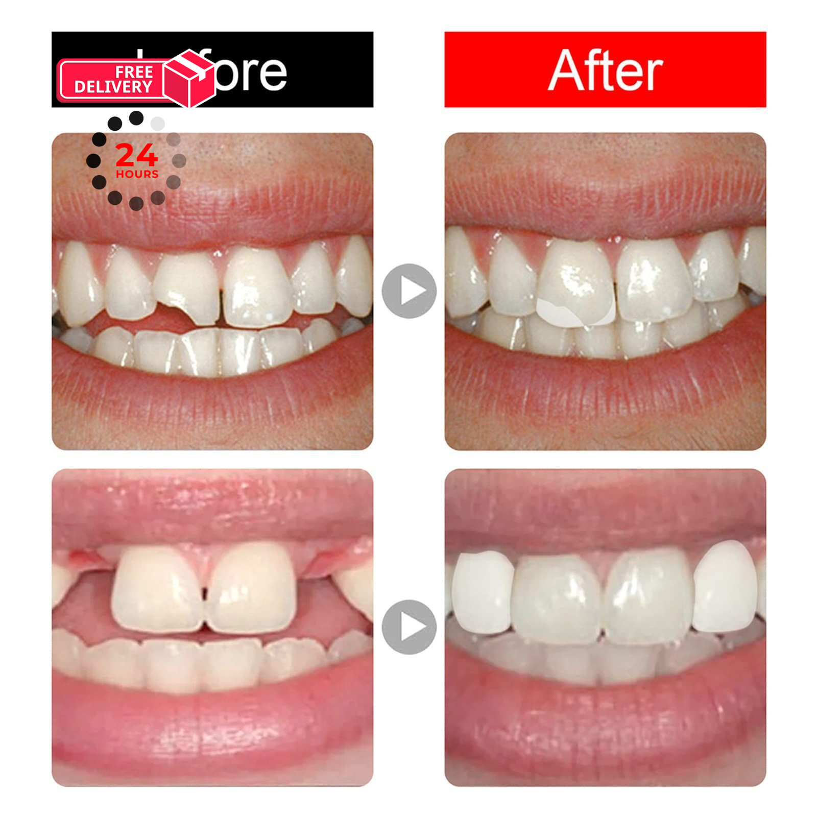 168 Pieces False Teeth Dental Complete Acrylic Resin Denture Teeth, 6 Sets…