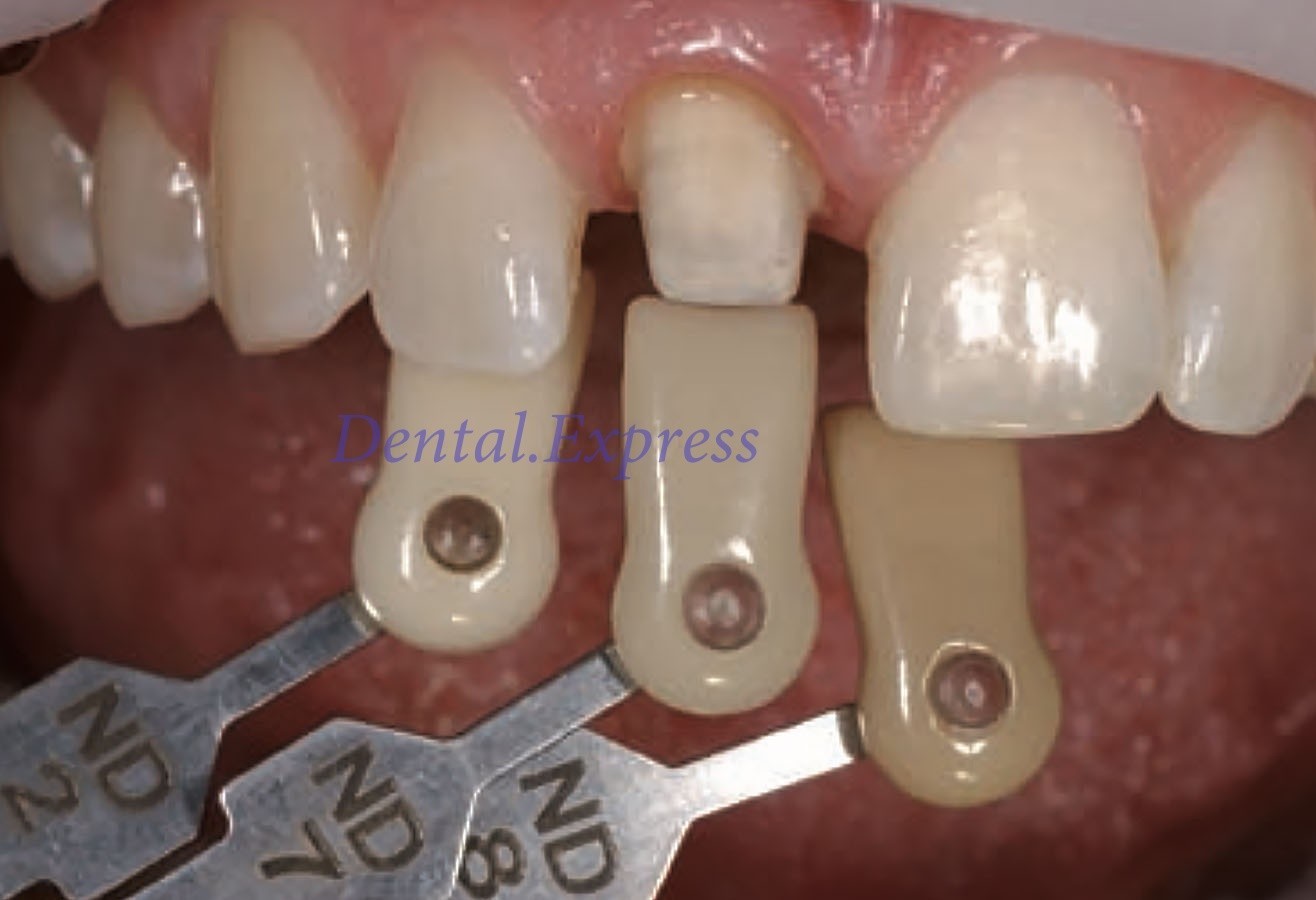 Ivoclar Vivadent Dental Shade Guide A-D 20 IPS or Natural Die ND1-9 Bleach Teeth