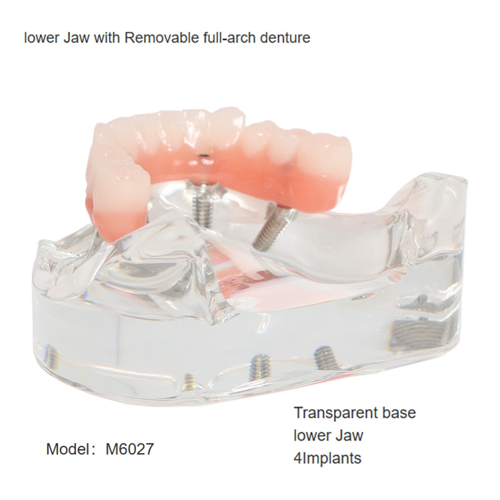 All-On-4 Dental Implant System Overdenture Treatment Teeth Model U/L Jaw W/screw