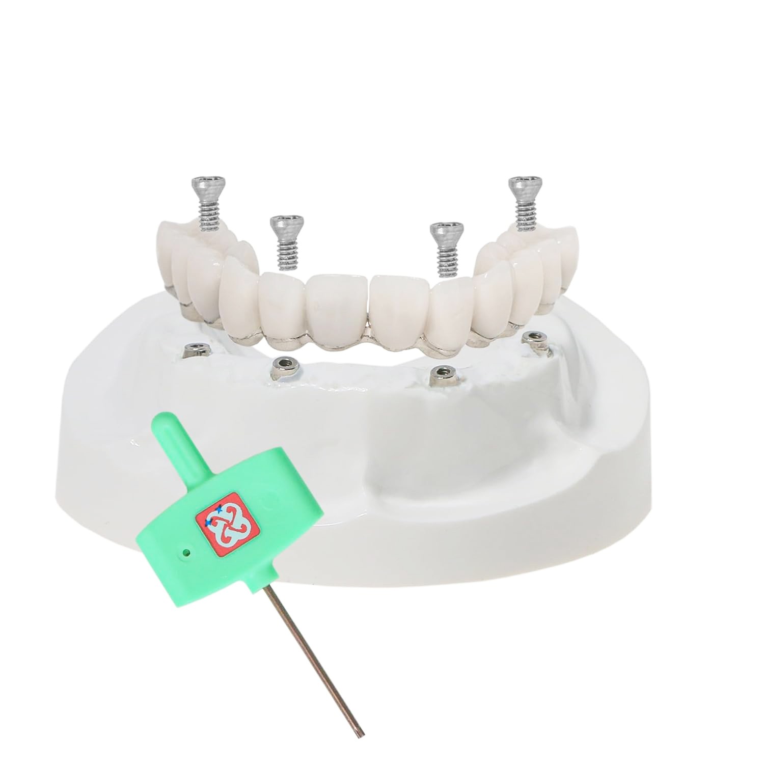 Dental All-on-4 Overdenture Model Upper Jaw Implants Restoration 4 Screws M6023