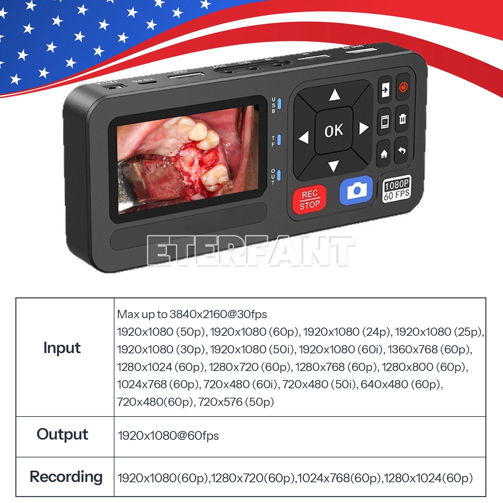 ETERFANT Medical Portable Surgical Recorder for Laparoscopy&Endoscopy Capture US