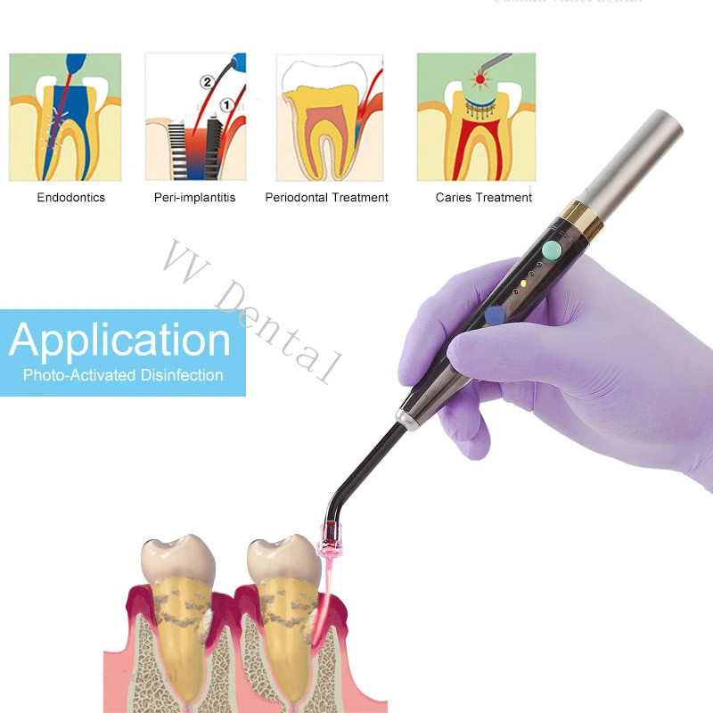 Dental Diode Laser System Cordless Wireless laser Pen soft tissue Perio Endo