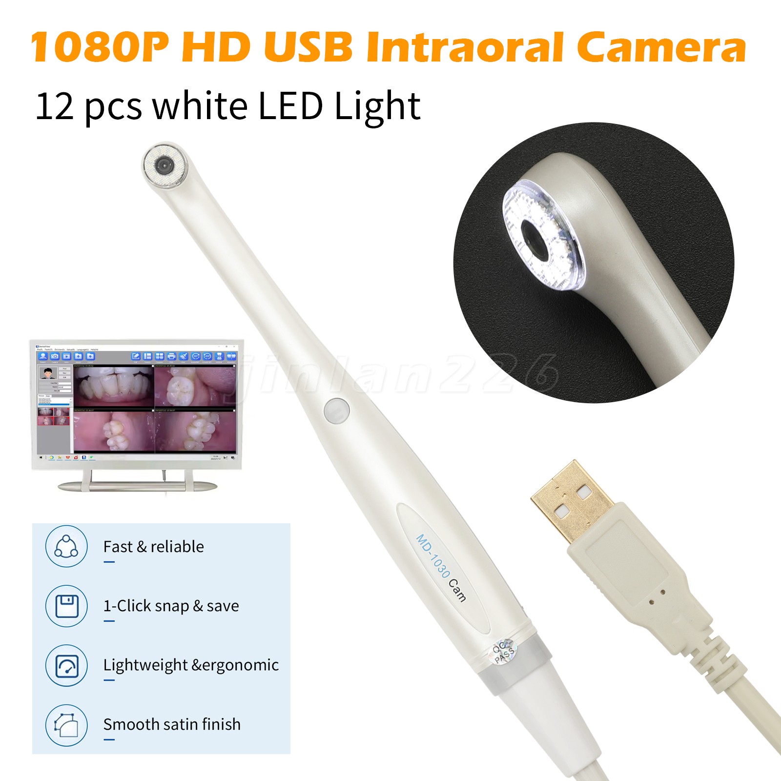 USB Dental Intraoral Oral Camera 1/4 sony CCD Fit TWAIN
