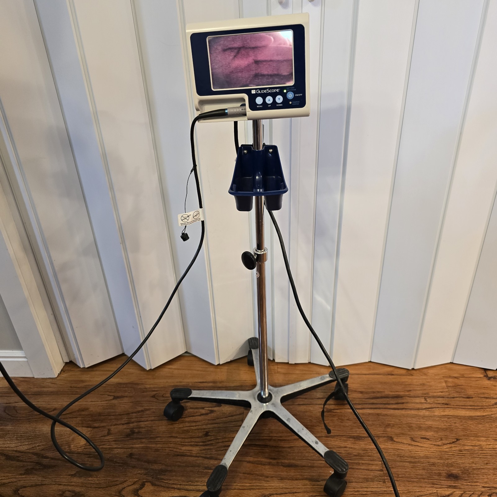Verathon 0231-0003 GVL Glidescope Monitor, 0570-0210 Laryngoscope Baton W/Stand