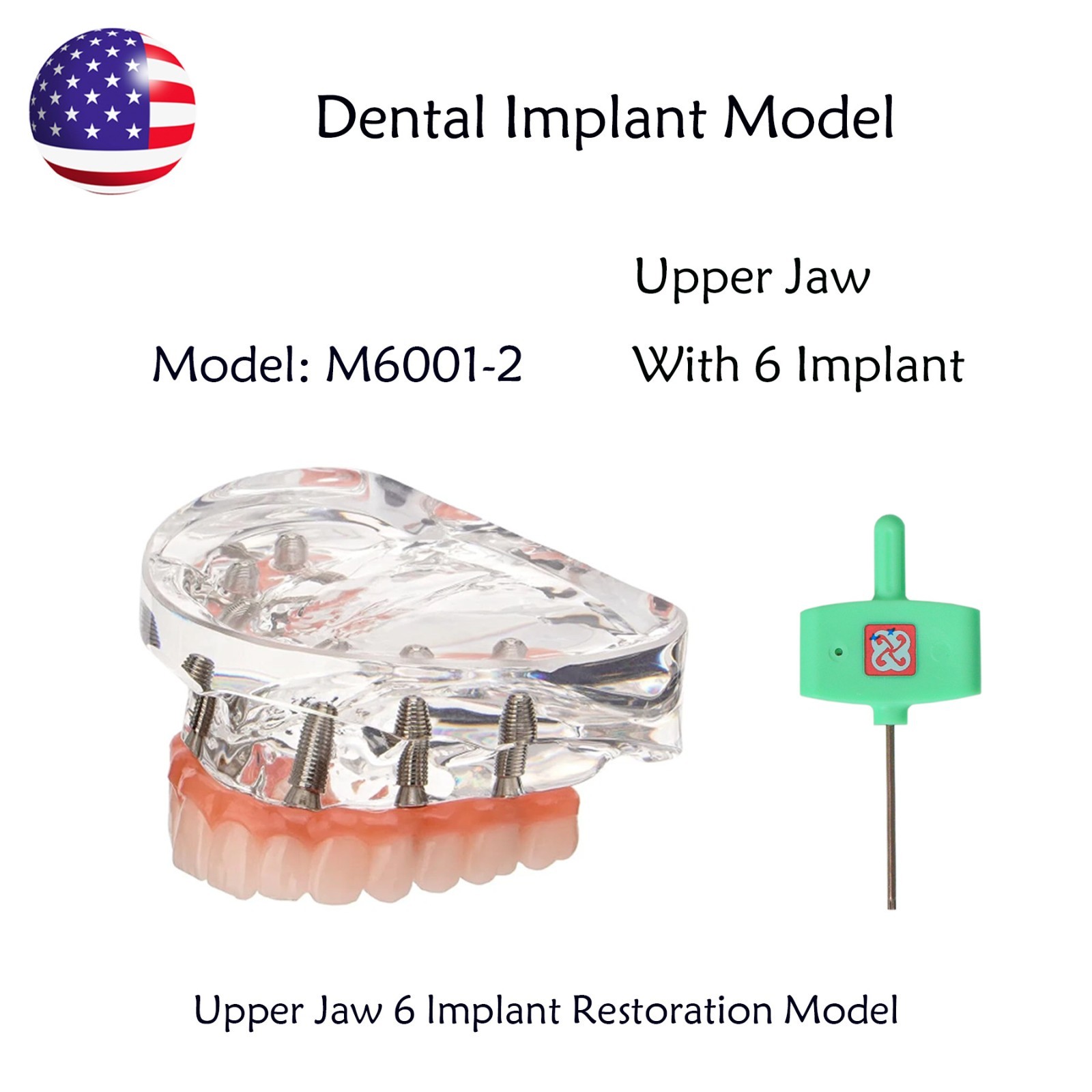 US Dental Implant Overdenture Model All-on-4/6 Upper Jaw Restoration 4/6 Screws