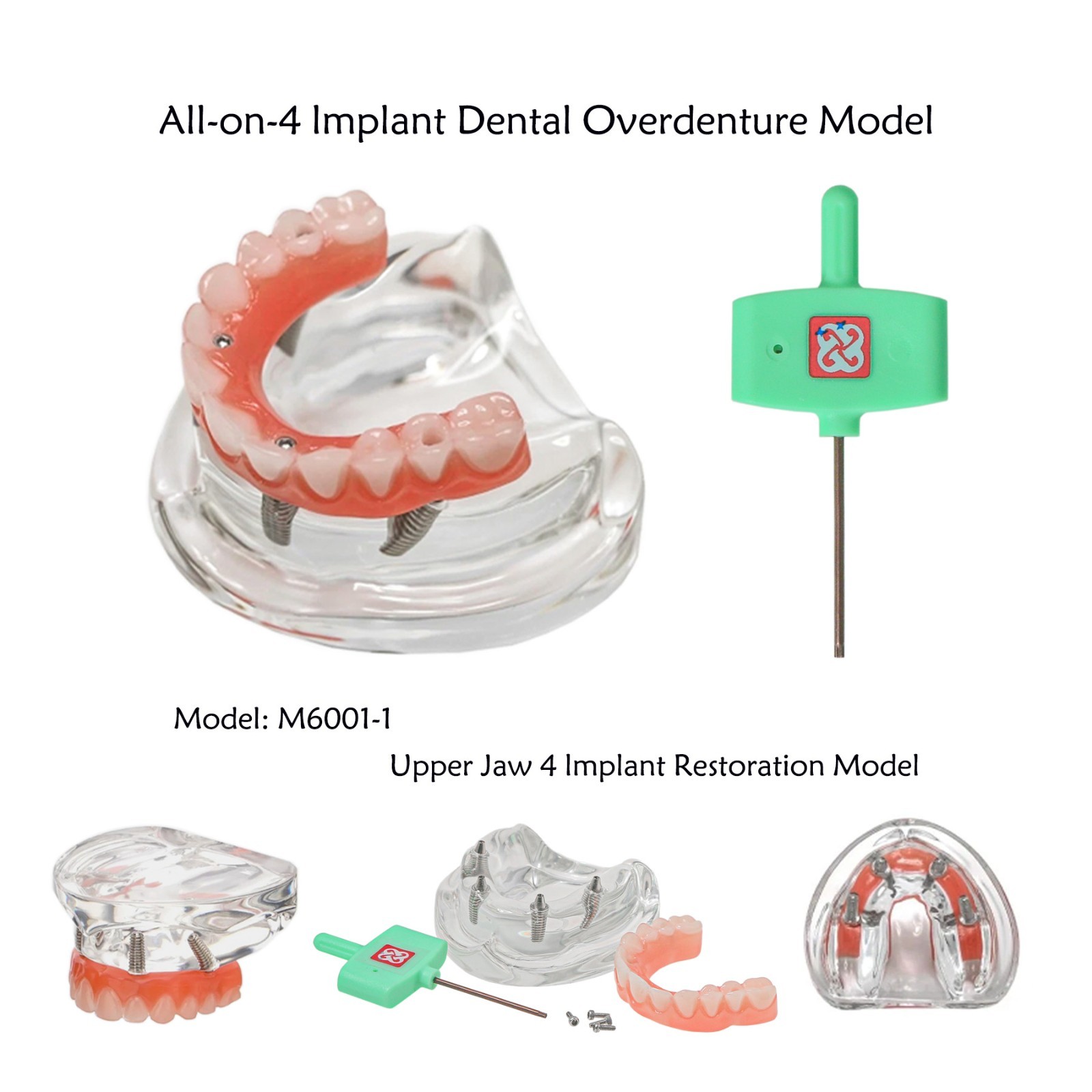 US Dental Implant Overdenture Model All-on-4/6 Upper Jaw Restoration 4/6 Screws