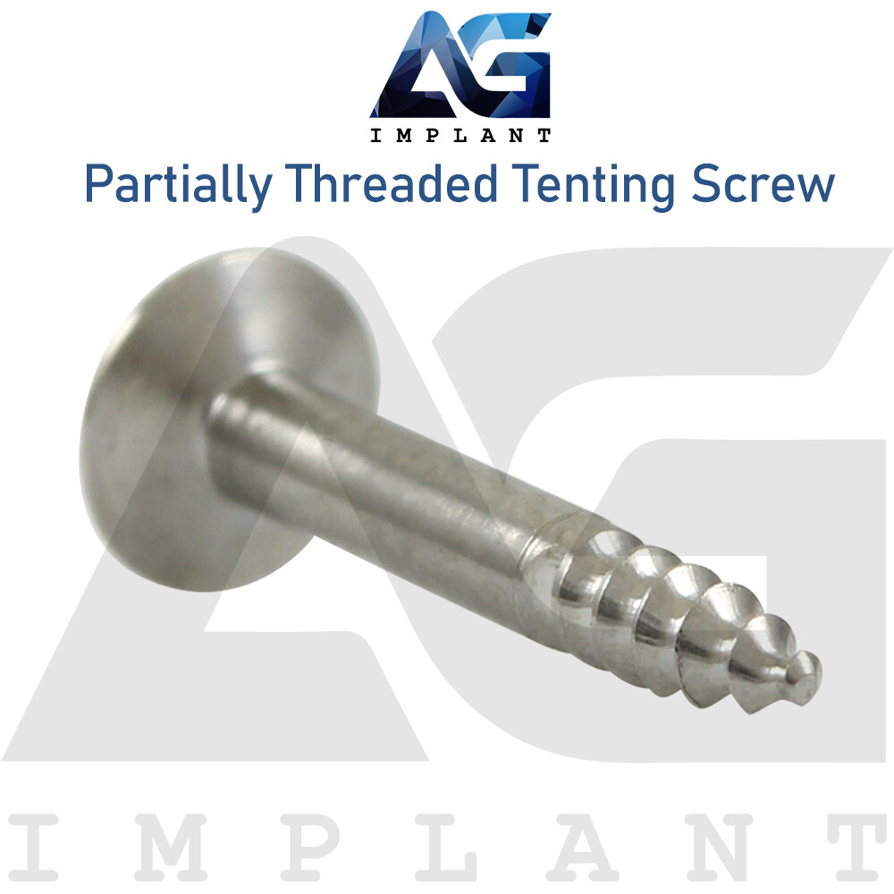 10 Titanium Part Threaded Tenting Screw Guided Regeneration GBR Membrane