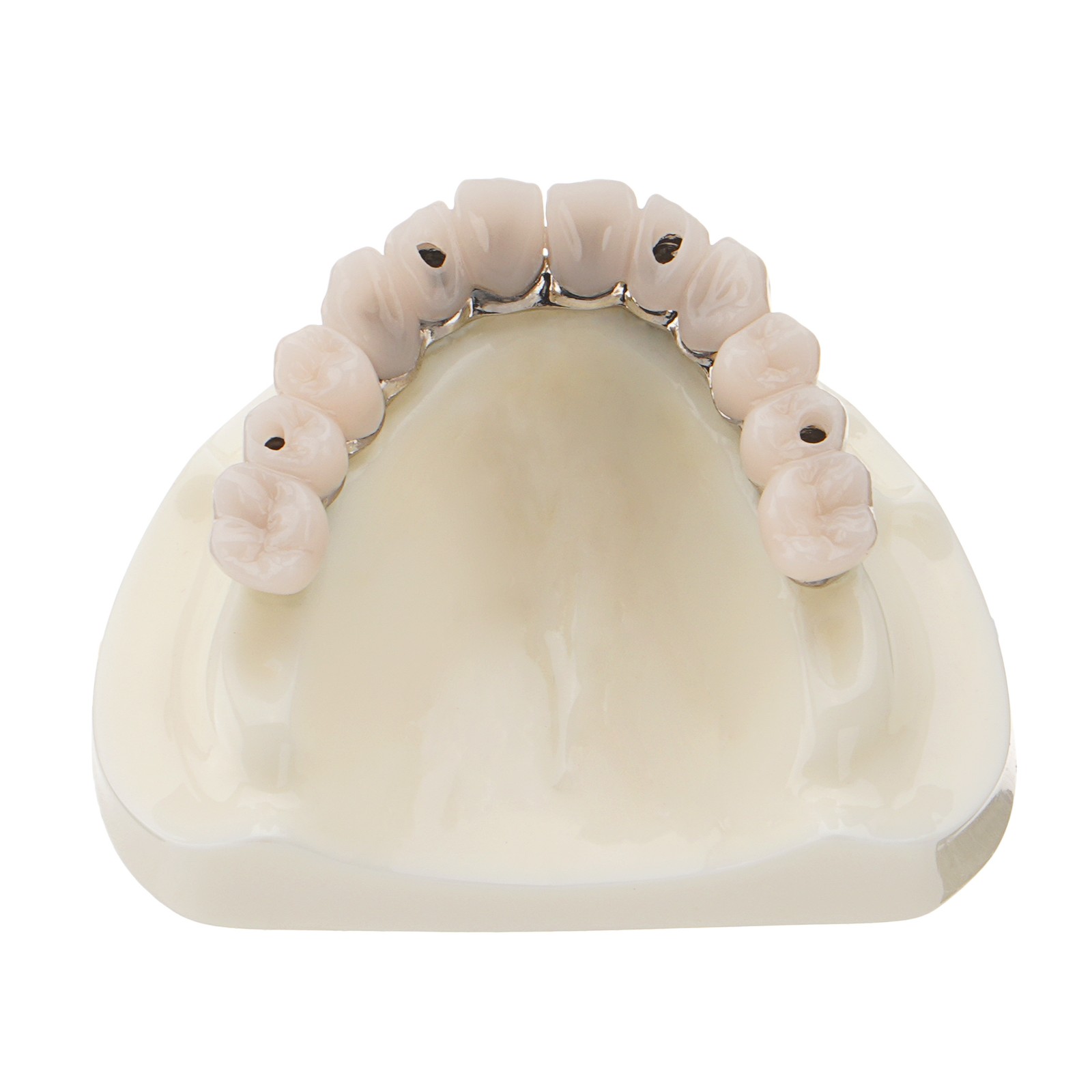Dental All-on-4 Overdenture Model Upper Jaw Implants Restoration 4 Screws M6023