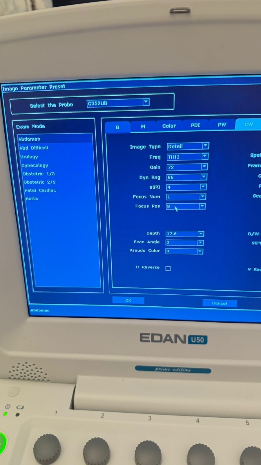 EDAN U50 DEMO Ultrasound System with 2 probes