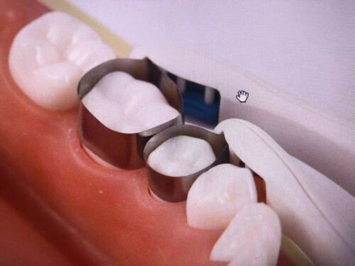 10x Dental Pro Metal Matrix Bands Sectional Contoured Tofflemire Rolls 4.5mm 6mm
