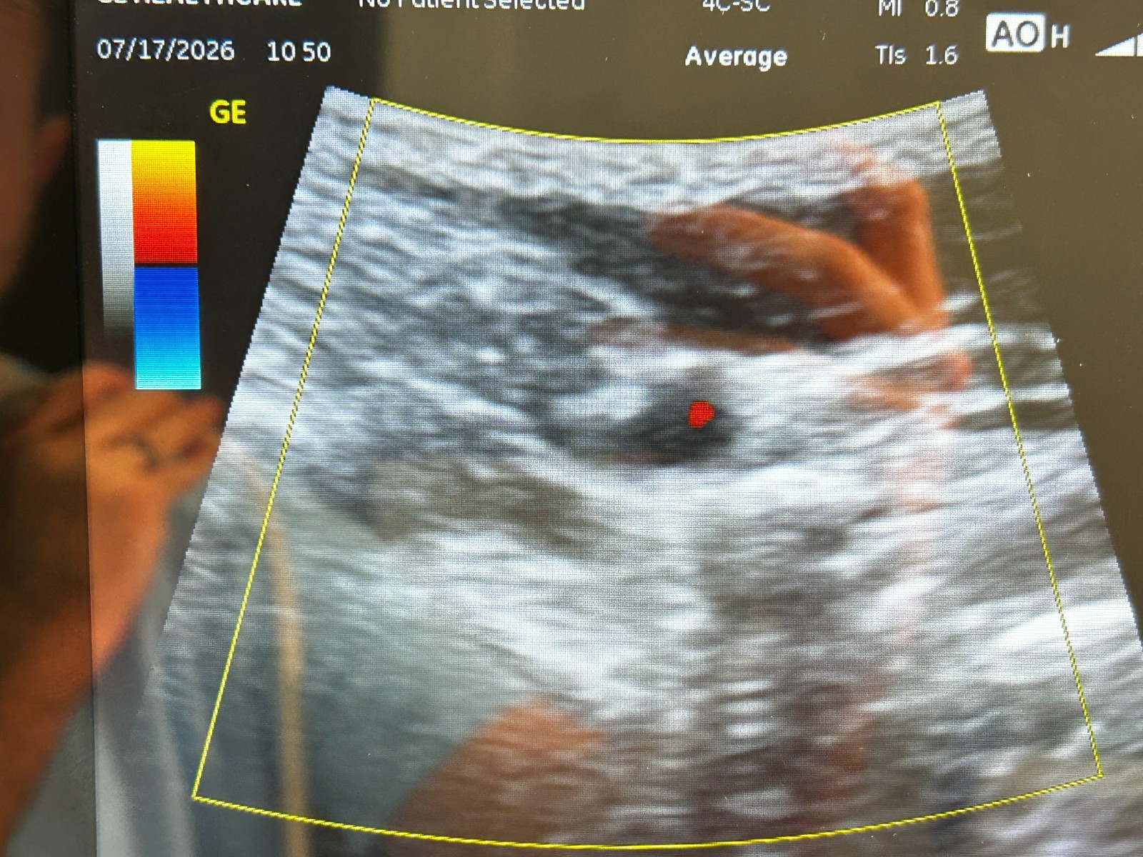 GE Venue 40 Anesthesia Ultrasound with GE 4C-SC Transducer