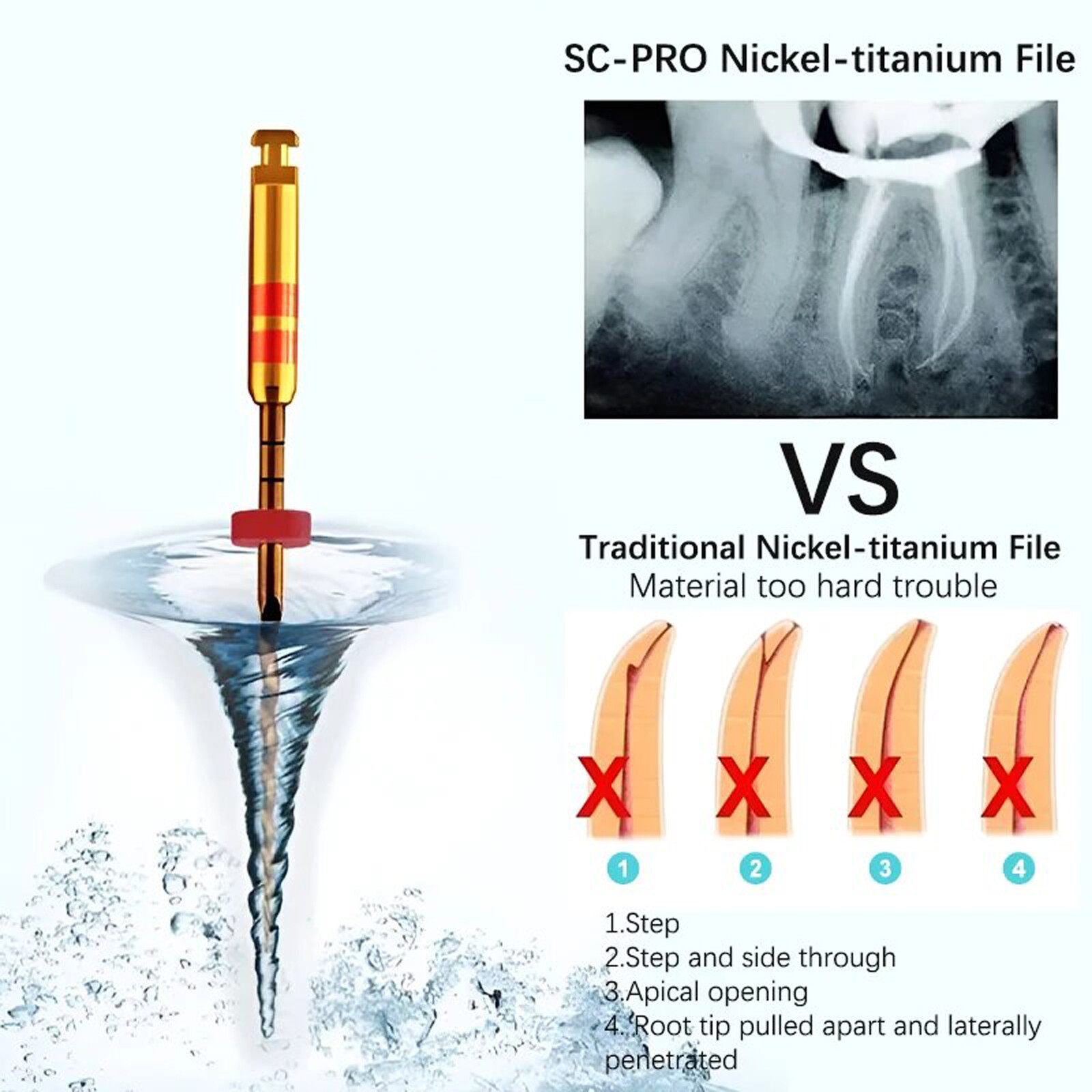 COXO SOCO SC-PRO Endo Controlled Memory NITI Gold Files Mixed 21/25/31mm