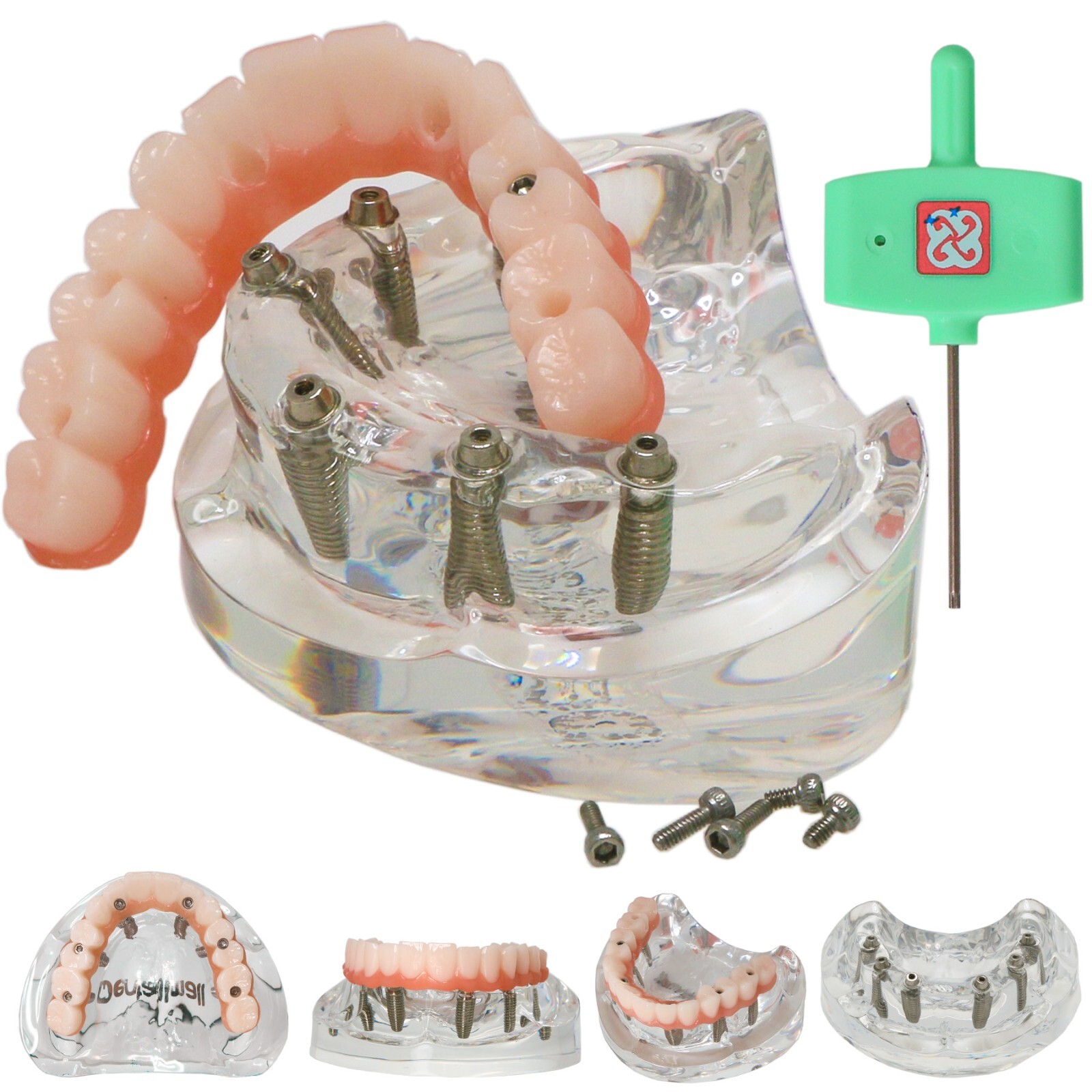 Dental Implant Model Upper Lower Jaw Demo All on 4/6 Overdenture treatment model