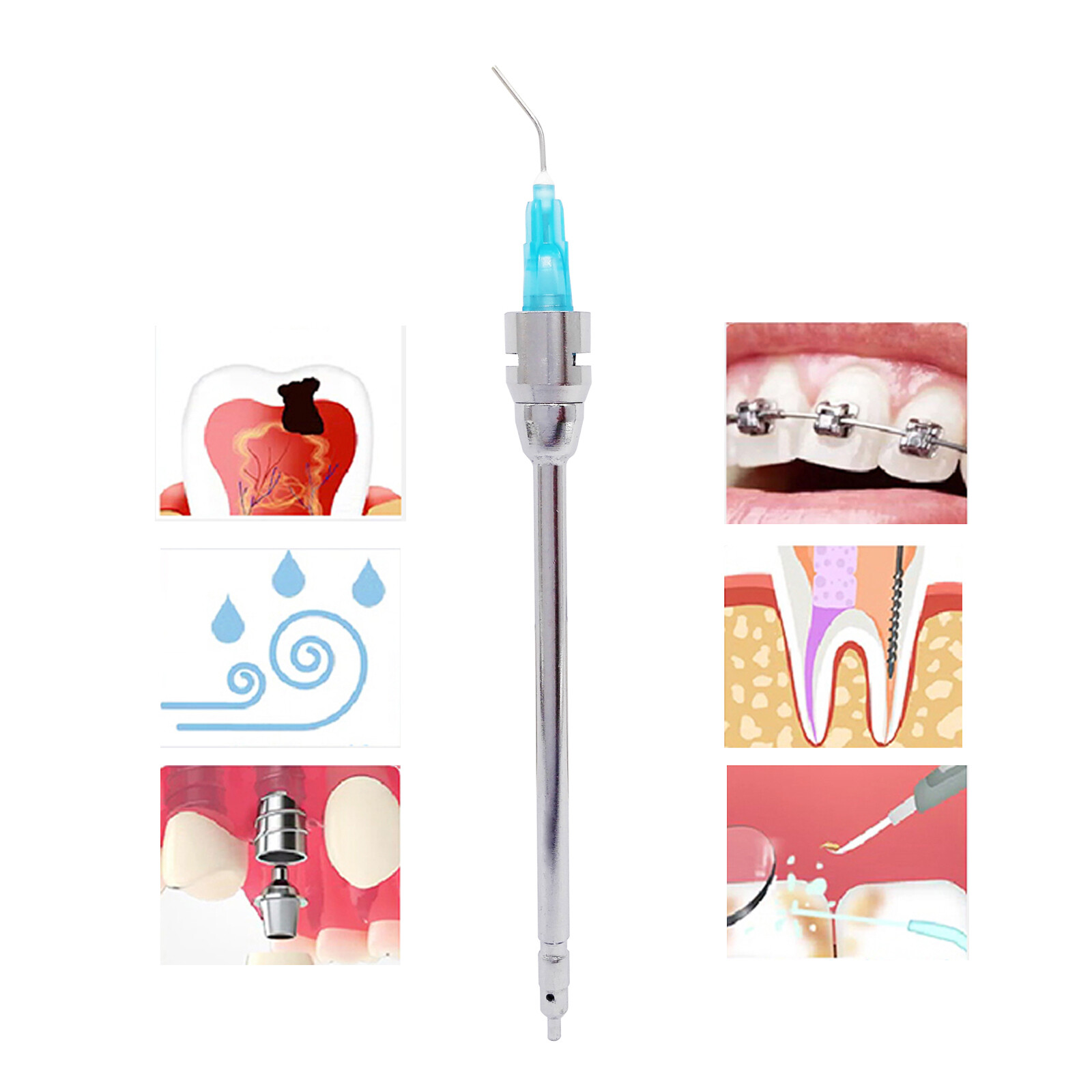 Stropko Style Dental Air Water Irrigation Tips 3-Way Gun Irrigator Dry Fits Kerr
