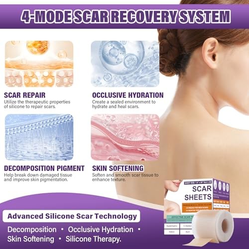 Medical Grade Silicone Scar Tape Roll 1.6″ x 59″ Reusable Sheet for Surgery Burn