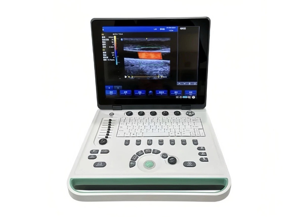 15″ Portable Laptop Ultrasound Scanner Machine Diagnostics Ultrasound System