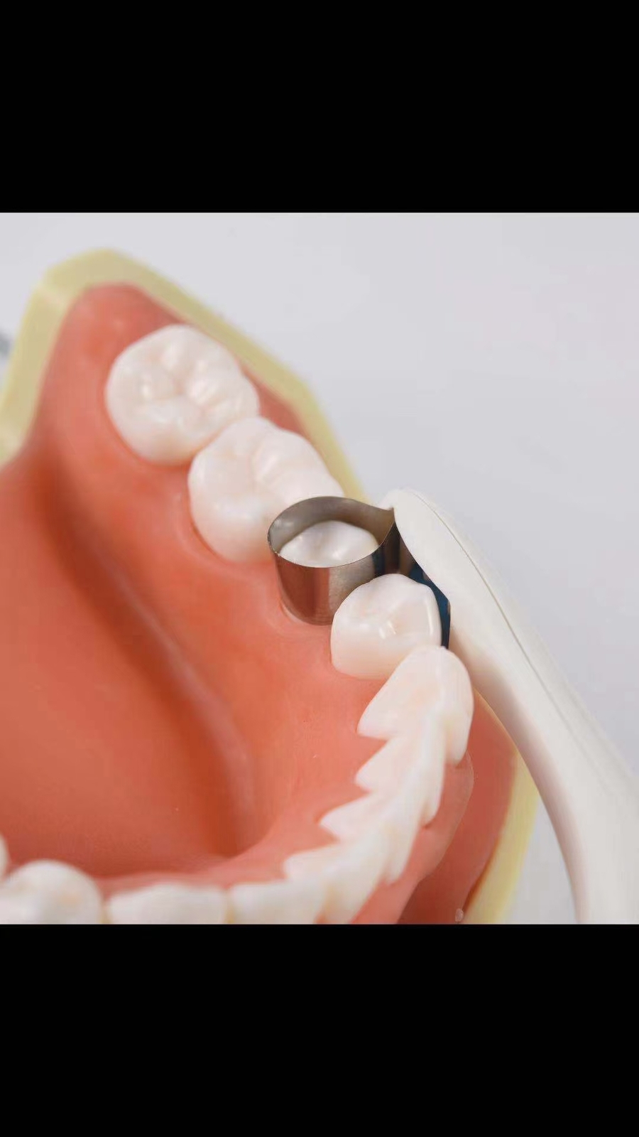 Dental Pro Metal Matrix Bands Molar/Premolar pre formed Bands Restoration Adjust