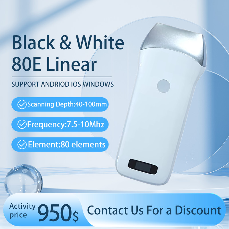 Wireless Ultrasound Probe Scanner Portable Machine Support iOS Android Windows